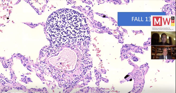 why covid vaccines cannot work